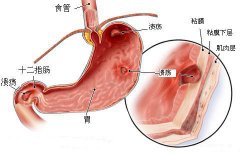 大連胃病檢查多少錢(qián)